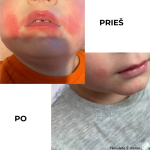 Apsauginis pieštukas, daugiafunkcis pieštukinis balzamas, natūrali kosmetika, odos priežiūra, natūrali odos piežiūra, priemonė vaikams, kosmetika